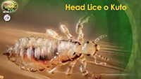 http://healinggaling.ph/wp-content/uploads/2016/05/headlice-wpcf_200x113.png