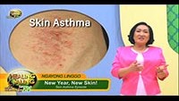 http://healinggaling.ph/wp-content/uploads/sites/5/2018/02/Skin-Asthma-wpcf_200x113.jpg