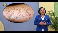 http://healinggaling.ph/wp-content/uploads/sites/5/2018/09/skin_cancer-wpcf_200x113.jpg