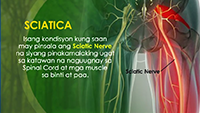 https://healinggaling.ph/ph/wp-content/uploads/sites/5/2016/03/sciatica-wpcf_200x113.png