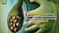 https://healinggaling.ph/ph/wp-content/uploads/sites/5/2016/06/gallstones-wpcf_200x113.png