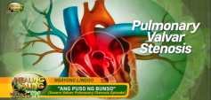https://healinggaling.ph/ph/wp-content/uploads/sites/5/2019/10/pulmonary-wpcf_237x113.png
