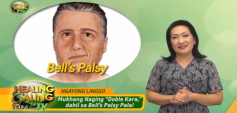 https://healinggaling.ph/ph/wp-content/uploads/sites/5/2020/02/bells_palsy-wpcf_237x113.png