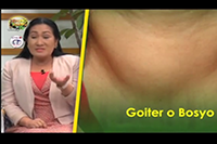 http://healinggaling.ph/wp-content/uploads/2016/10/goiter.png