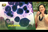 http://healinggaling.ph/wp-content/uploads/2016/10/leukemia.png