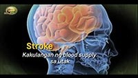 http://healinggaling.ph/wp-content/uploads/sites/5/2018/02/Stroke-wpcf_200x113.jpg
